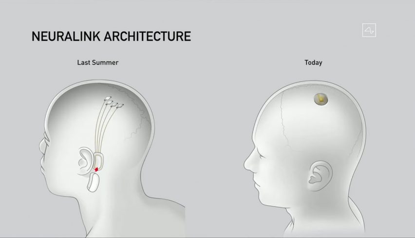 neuralink